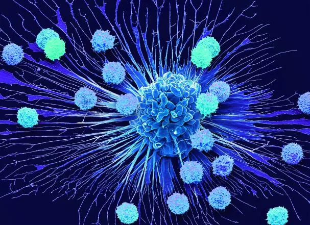 Color scanning electron micrograph (SEM) of T cells and an apoptotic cervical cancer cell (HeLa)