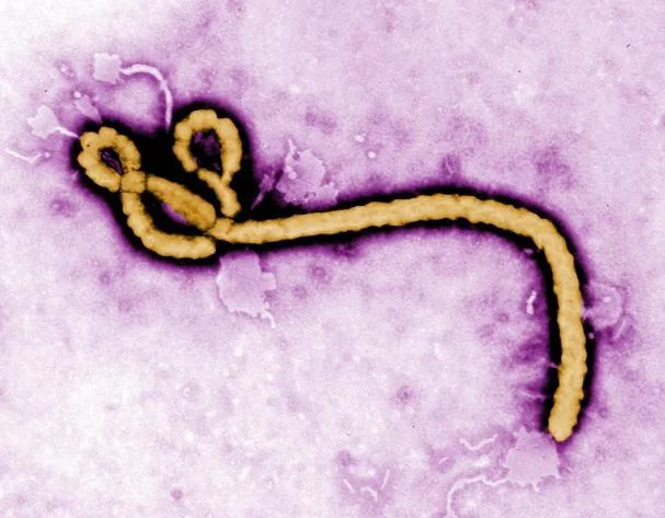 An Ebola virus, observed with transmission electron microscopy 