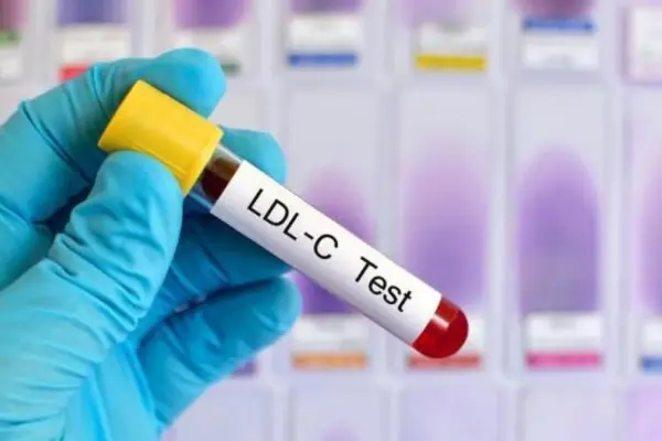 An RNA therapy reduces cholesterol durably with a single dose