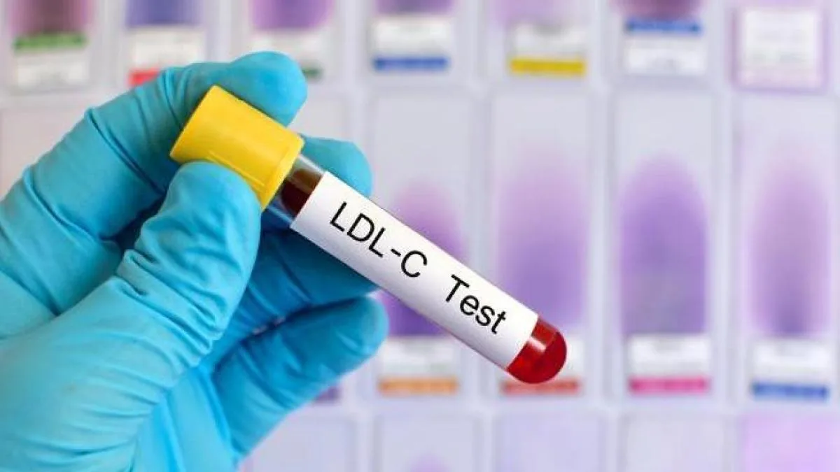 An RNA therapy reduces cholesterol durably with a single dose