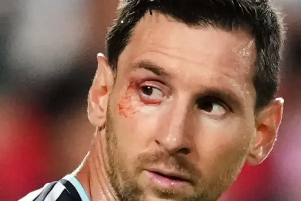 Leo Messi: the day of the goat