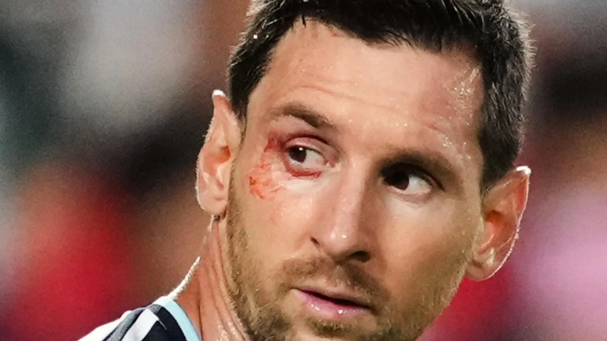Leo Messi: the day of the goat
