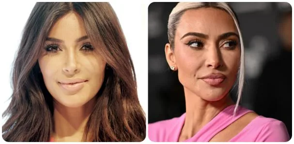 Kim Kardashian, before and after.