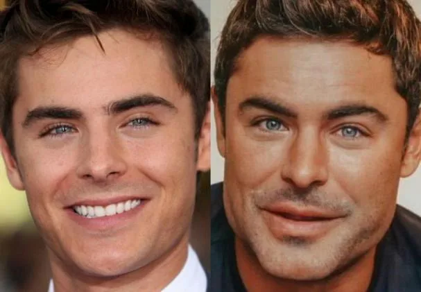 Zac Efron, before and after.