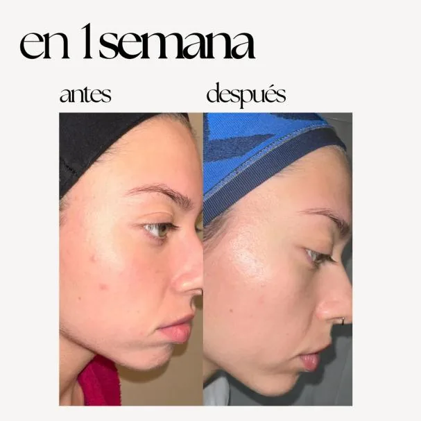 Today, multifunctional treatments like Skin Correct gain prominence in cosmetics because they do not respond to a single isolated problem, but accompany skin that needs to act on several levels at once