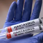 Health authorities report the case of a tourist with isolated hantavirus in Spain