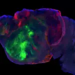Human neurons implanted in mice accelerate the study of mental disorders