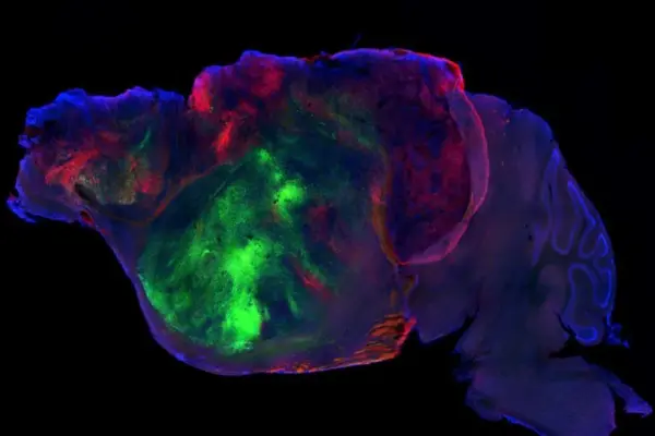 Human neurons implanted in mice accelerate the study of mental disorders