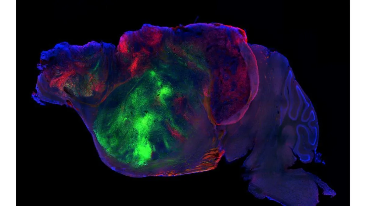 Human neurons implanted in mice accelerate the study of mental disorders